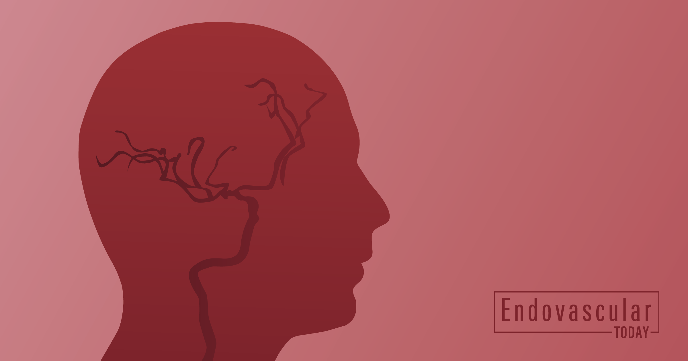 FDA Clears Rapid Medical’s Drivewire, a Steerable Neurovascular ...