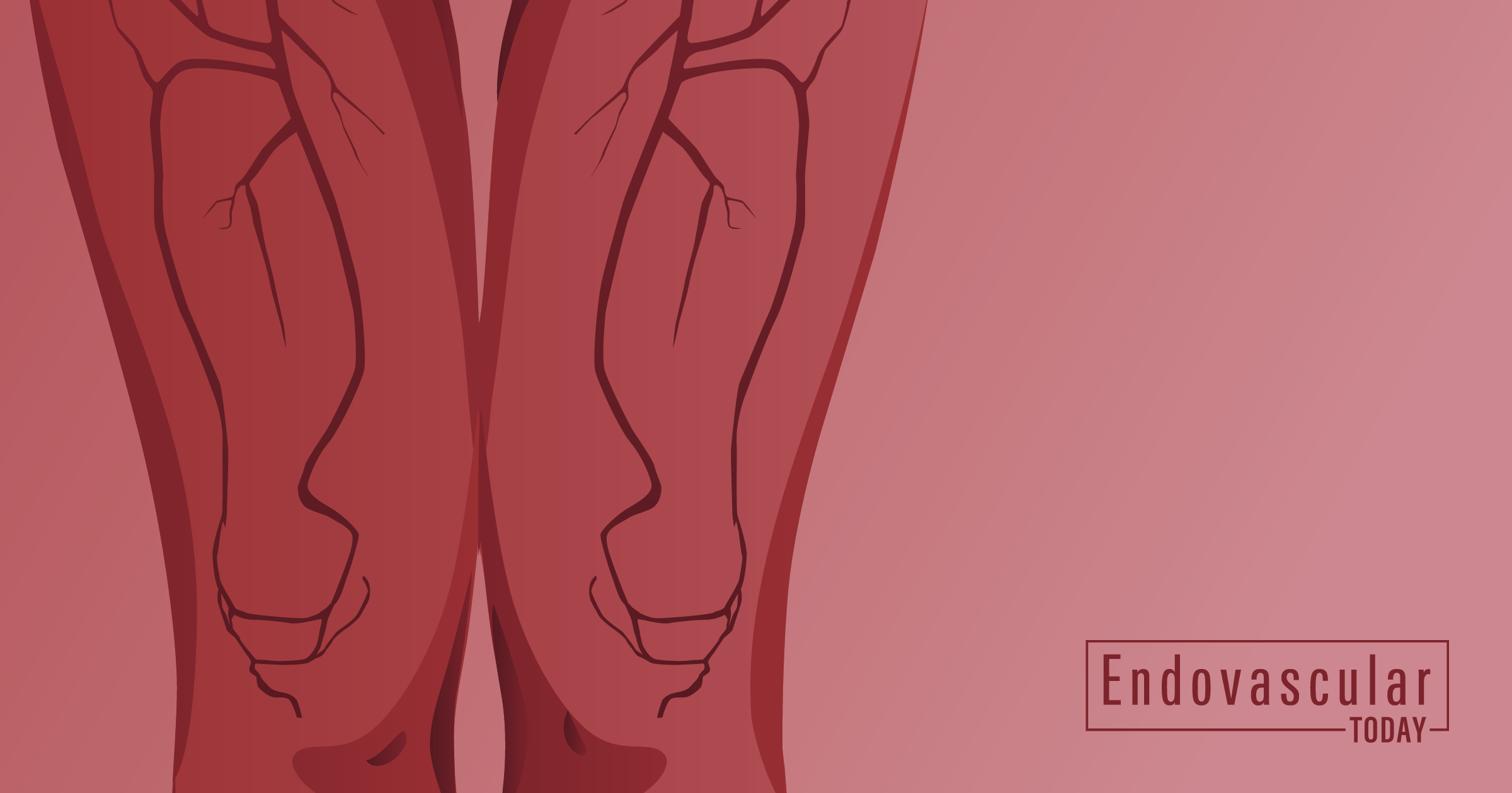 DISFORM Classification System Developed for Angioplasty-Induced ...